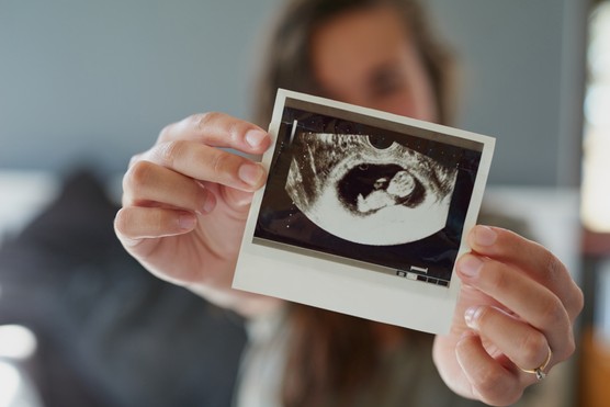12-week-pregnancy-scan woman showing her 12-week pregnancy scan to the camera